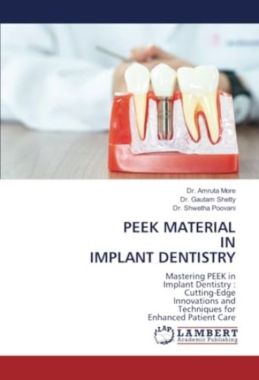 Peek Material in Implant Dentistry