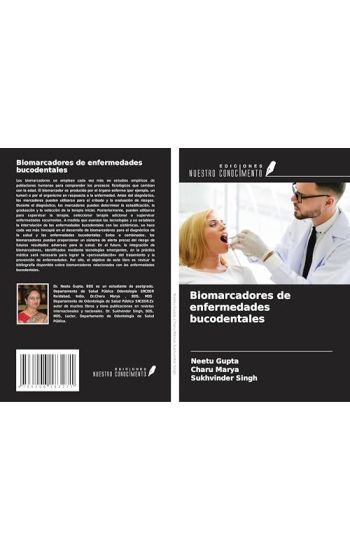 Biomarcadores de enfermedades bucodentales