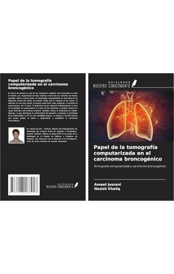 Papel de la tomografía computarizada en el carcinoma broncogénico
