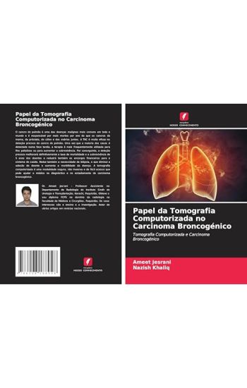 Papel da Tomografia Computorizada no Carcinoma Broncogénico