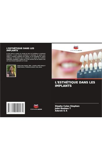 L'Esthétique Dans Les Implants