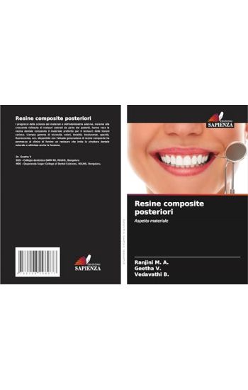 Resine composite posteriori