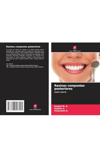 Resinas compostas posteriores
