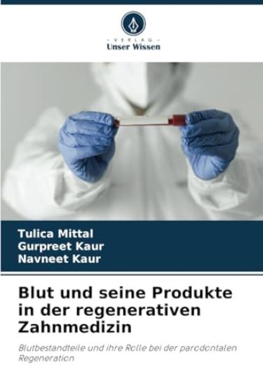 Blut und seine Produkte in der regenerativen Zahnmedizin
