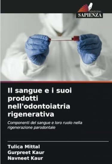 Il sangue e i suoi prodotti nell'odontoiatria rigenerativa