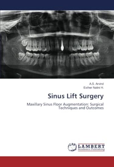 Sinus Lift Surgery