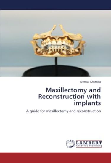 Maxillectomy and Reconstruction with implants