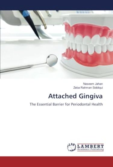 Attached Gingiva