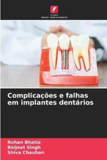 Complicações e falhas em implantes dentários
