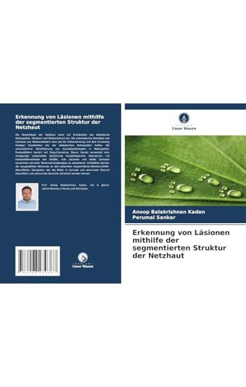 Erkennung von Läsionen mithilfe der segmentierten Struktur der Netzhaut