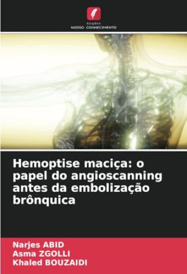Hemoptise maciça