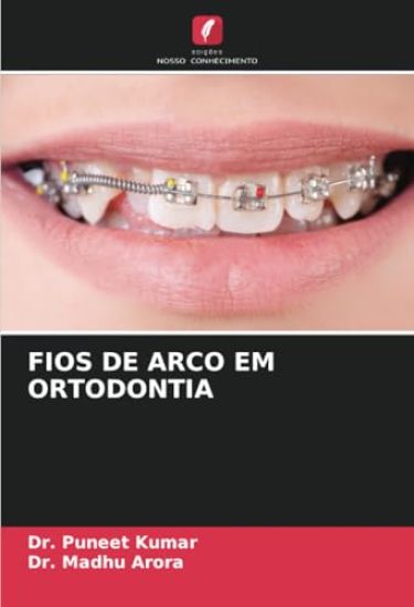 Fios de Arco Em Ortodontia