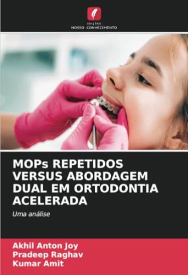 MOPs REPETIDOS VERSUS ABORDAGEM DUAL EM ORTODONTIA ACELERADA