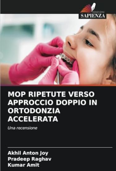 Mop Ripetute Verso Approccio Doppio in Ortodonzia Accelerata