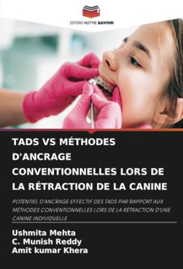 Tads Vs Méthodes d'Ancrage Conventionnelles Lors de la Rétraction de la Canine