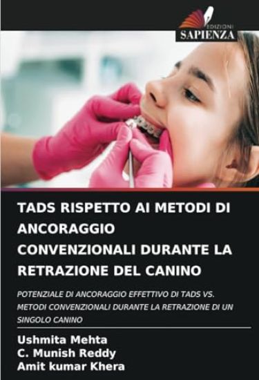 Tads Rispetto AI Metodi Di Ancoraggio Convenzionali Durante La Retrazione del Canino