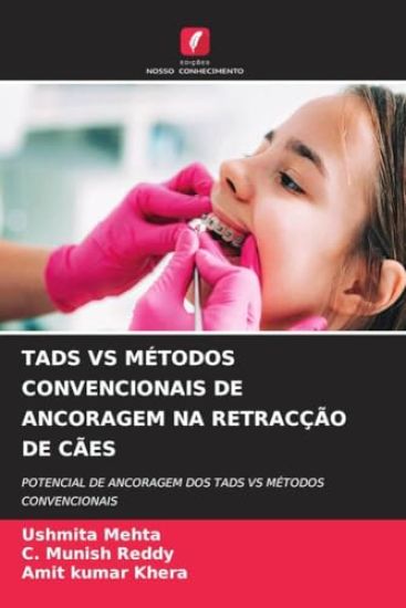 Tads Vs Métodos Convencionais de Ancoragem Na Retracção de Cães