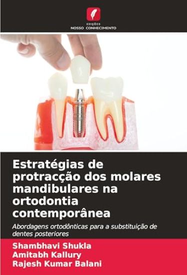 Estratégias de protracção dos molares mandibulares na ortodontia contemporânea