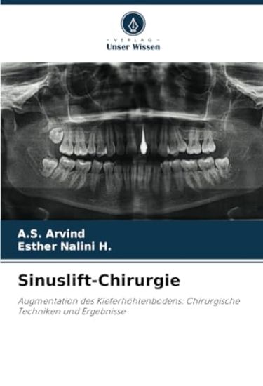 Sinuslift-Chirurgie