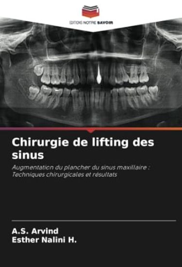 Chirurgie de lifting des sinus