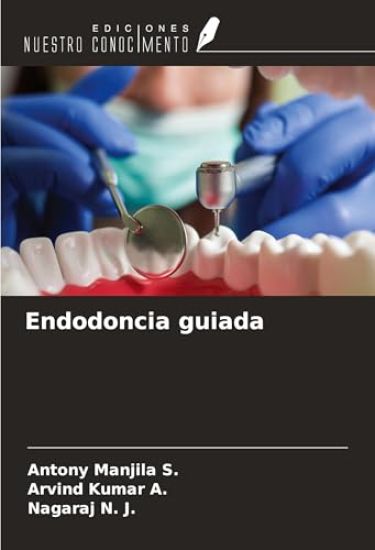 Endodoncia guiada