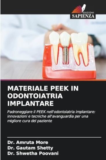 Materiale Peek in Odontoiatria Implantare