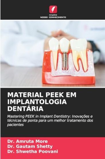 Material Peek Em Implantologia Dentária
