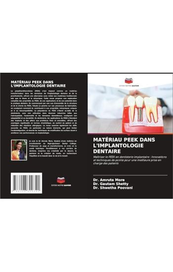 Matériau Peek Dans l'Implantologie Dentaire