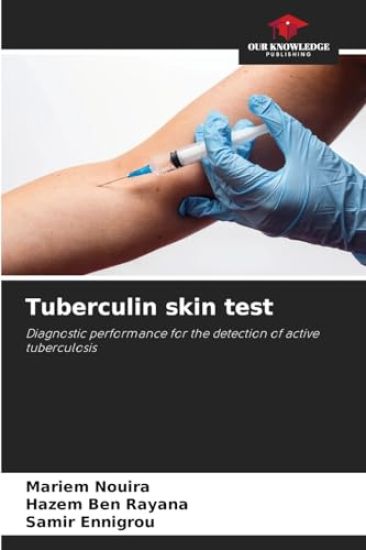 Tuberculin skin test