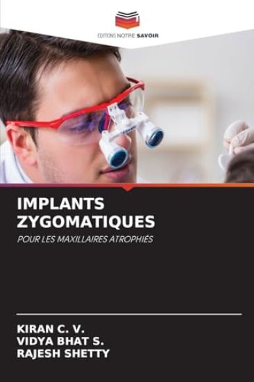 Implants Zygomatiques