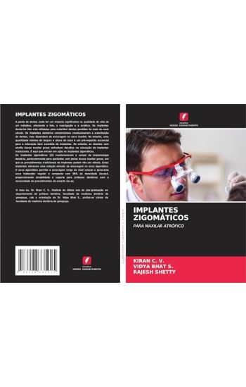 Implantes Zigomáticos