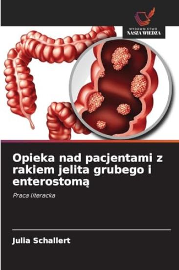 Opieka nad pacjentami z rakiem jelita grubego i enterostoma