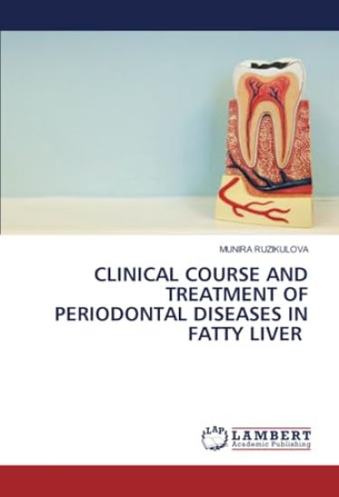 Clinical Course and Treatment of Periodontal Diseases in Fatty Liver
