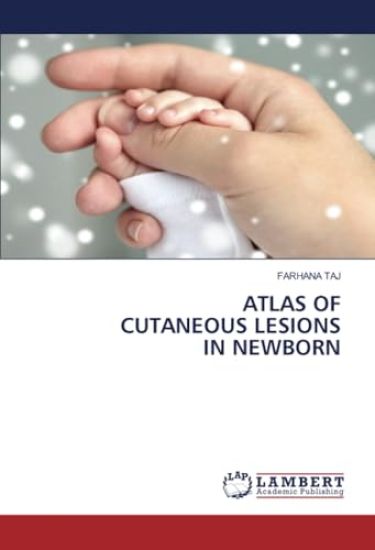 Atlas of Cutaneous Lesions in Newborn