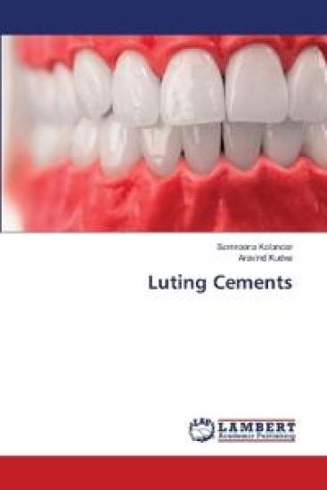 Luting Cements