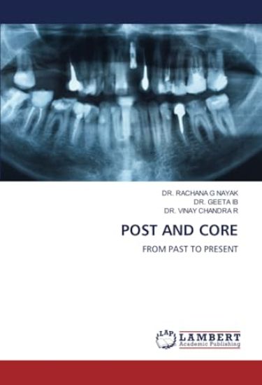 Post and Core