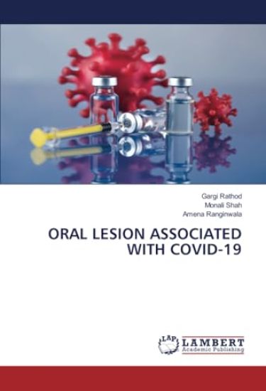 Oral Lesion Associated with Covid-19