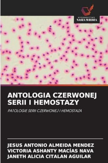 Antologia Czerwonej Serii I Hemostazy