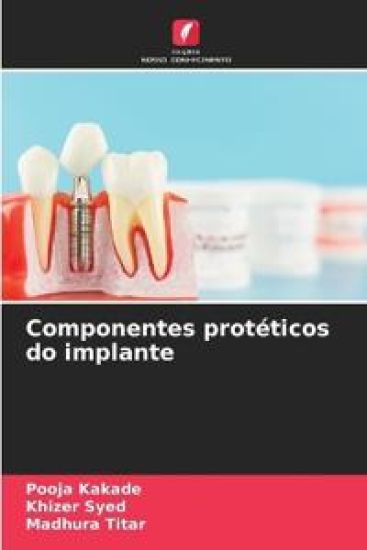 Componentes protéticos do implante