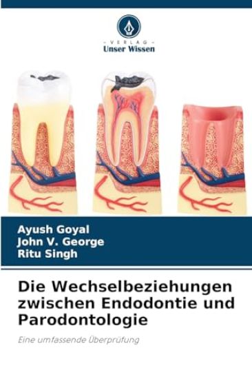 Die Wechselbeziehungen zwischen Endodontie und Parodontologie