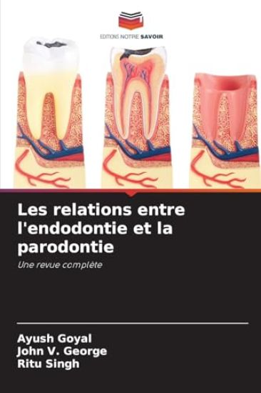 Les relations entre l'endodontie et la parodontie