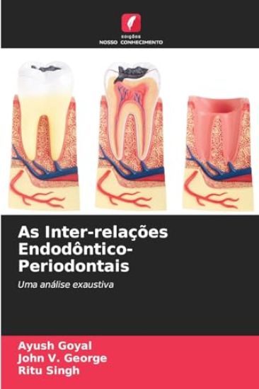 As Inter-relações Endodôntico-Periodontais