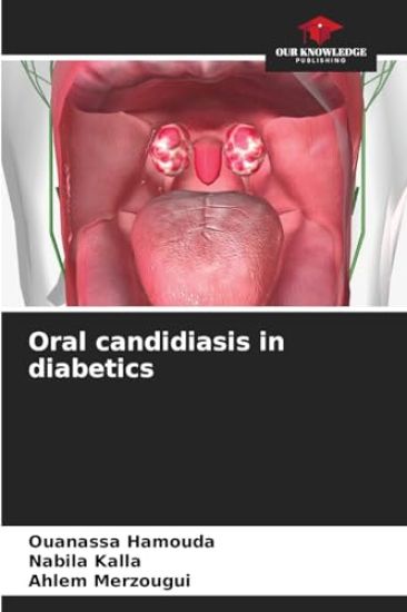 Oral candidiasis in diabetics