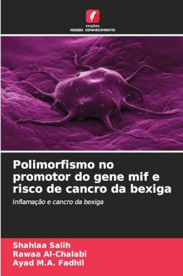 Polimorfismo no promotor do gene mif e risco de cancro da bexiga