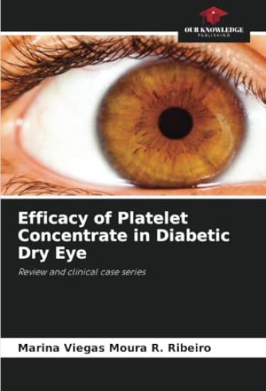Efficacy of Platelet Concentrate in Diabetic Dry Eye