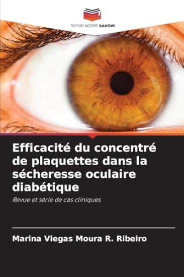 Efficacité du concentré de plaquettes dans la sécheresse oculaire diabétique