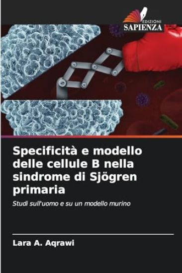 Specificità e modello delle cellule B nella sindrome di Sjögren primaria