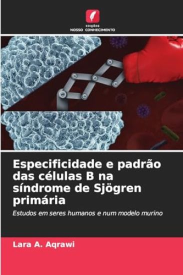 Especificidade e padrão das células B na síndrome de Sjögren primária