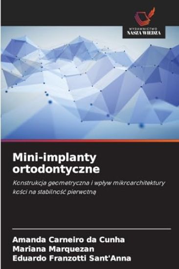 Mini-implanty ortodontyczne