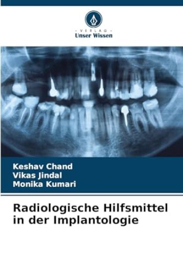 Radiologische Hilfsmittel in der Implantologie